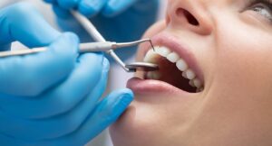 Dental Cleaning in Anchorage