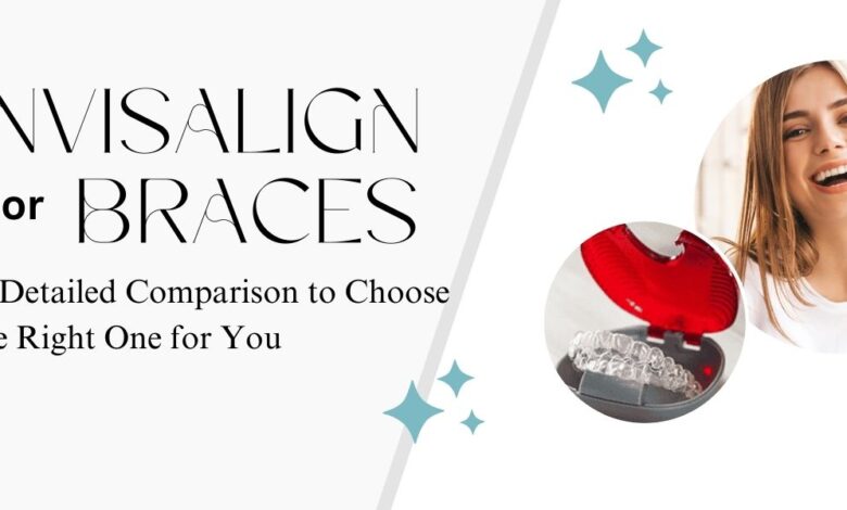 Invisalign or Braces: A Detailed Comparison to Choose the Right One for You