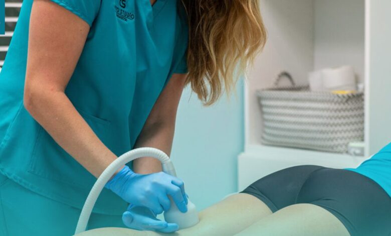 Cryo T-Shock|Tampa's Best Cellulite Treatment for Radiant Skin
