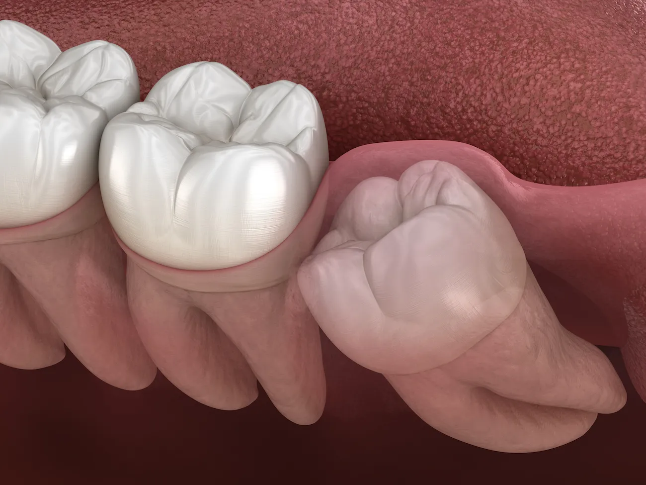 Oral and Maxillofacial Surgery in Glendale
