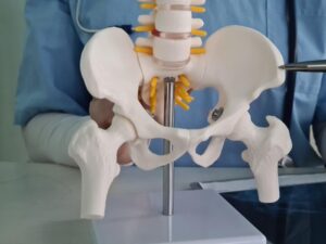 Hip Replacement Surgery in Delhi