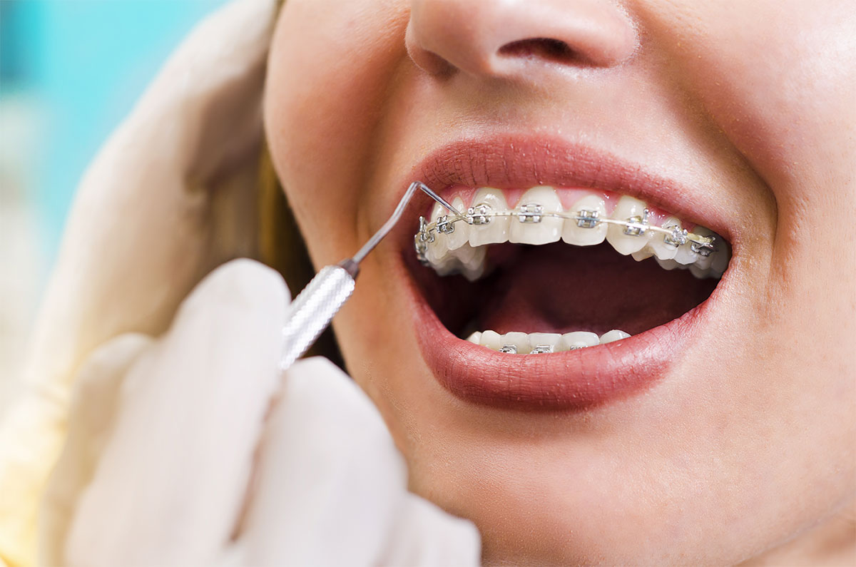 orthodontist-in-lahore