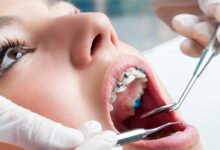 Best Orthodontic Clinics and Dentists in Dubai