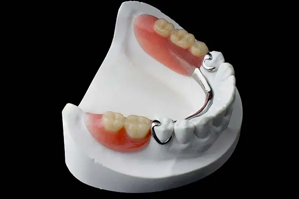 Learn about the benefits of surgical denture Edmonton, a modern solution enhancing comfort and functionality compared to traditional dentures. Understand how this innovation can transform your oral health.