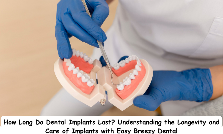 Dental Implants In Corpus Christi, Easy Breezy Dental