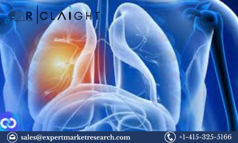 Non-Small Cell Lung Cancer Treatment Market