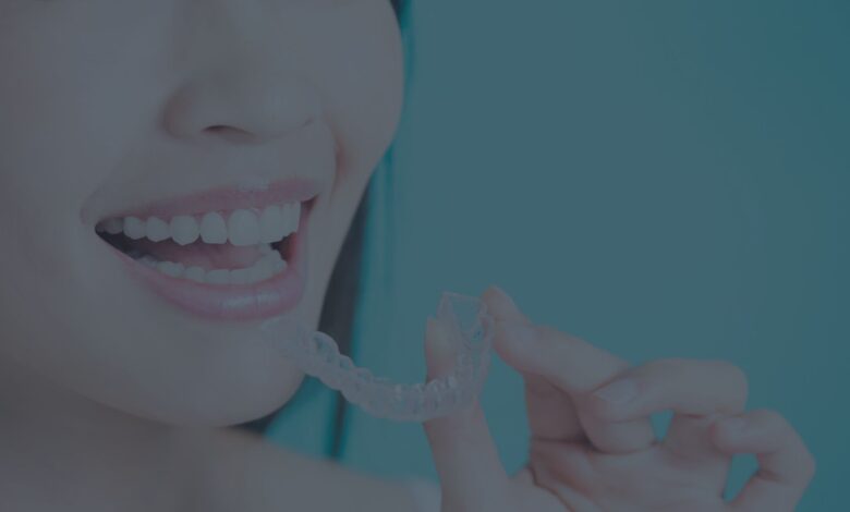 Invisalign-Clinic-in-Edmonton