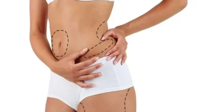 Patient Safety How the Best Liposuction Surgeon in Dubai Ensure a Secure Experience